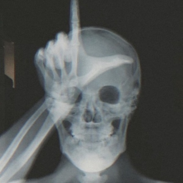 funny-pictures-x-ray-loser-thumb-5545618.jpeg